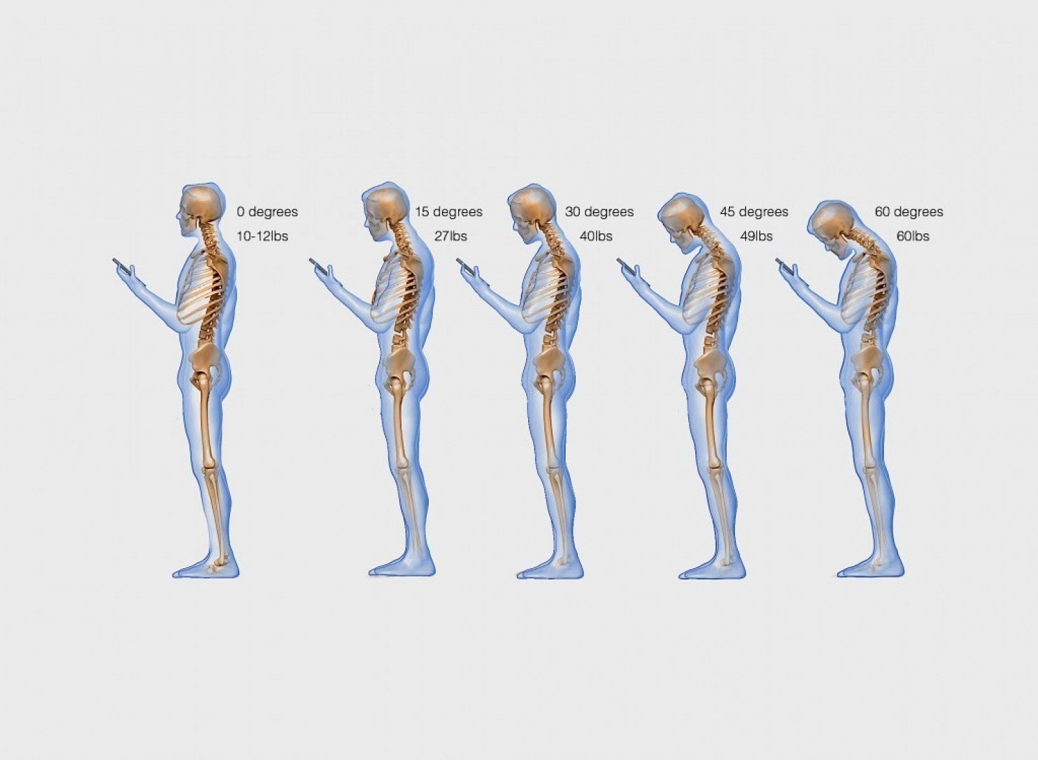 "Text Neck" 3 imrs.php